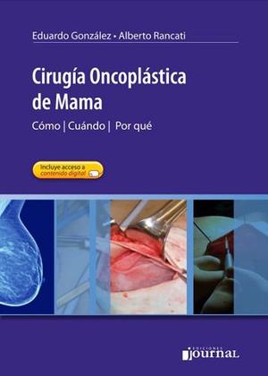 Eduardo González, Cirugía Oncoplástica De Mama