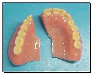 Protesis dental para una mejor sonrisa