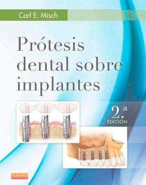 Misch - Prótesis E Implantología - Promoción 2 Libros