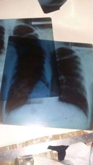 radiografias placas radiograficas usadas ver descripcion
