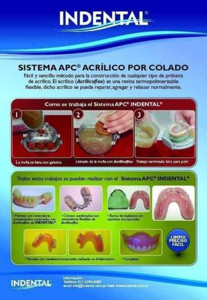 novedoso sistema de construccion de protesis de acrilico por