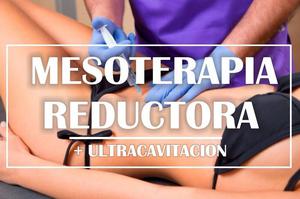 Mesoterapia Reductora + Ultracavitacion