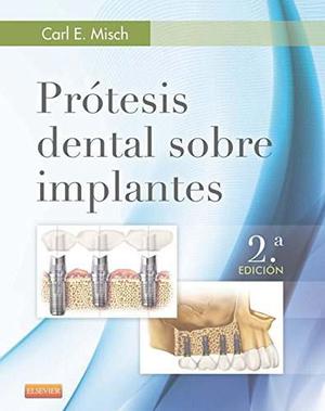 Prótesis Dental Sobre Implantes 2 - Carl E. Misch (digital)