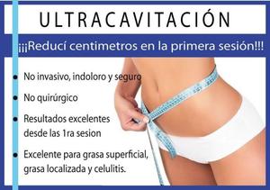 Ultracavitacion Selectiva -Comun