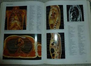 atlas de anatomía humana. rohen yokochi. harcourt.