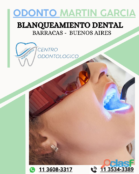 BLANQUEAMIENTO DENTAL