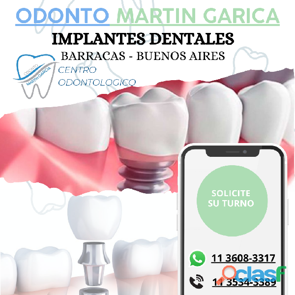 IMPLANTES DENTALES